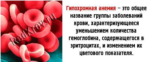 Гипохромная анемия кровь. Гипохромная анемия характеризуется. Гипохромная гипоцентарная анемия.