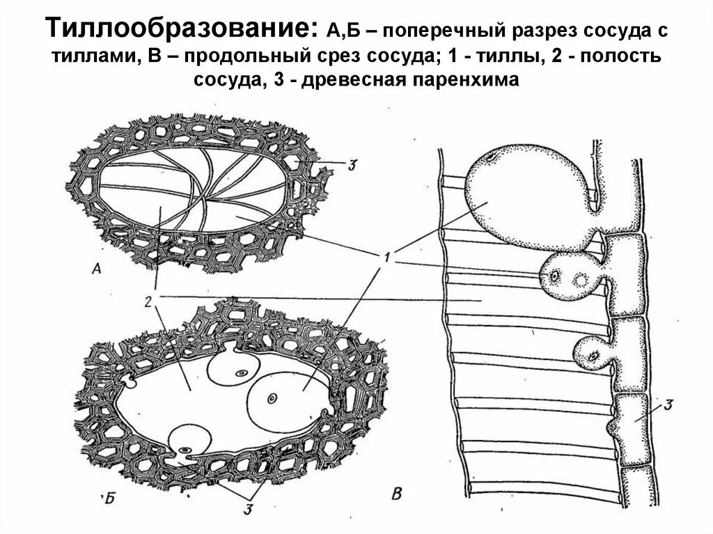 Поперечный и продольный срез. Поперечный разрез через сальниковую сумку. Поперечный разрез сосуда. Поперечный разрез через сальниковую сумку схема. Сосуды Ксилема в поперечном разрезе.