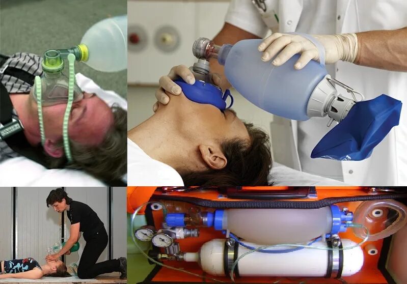 ивл через трахеостому. ивл через трахеостому. трахеостомия трубка дыхательная. экстренная трахеостомия. расширитель для трахеостомии.