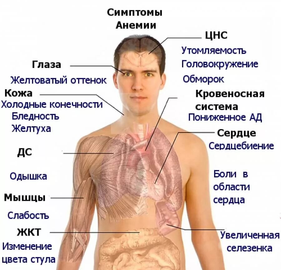 Назовите причины и способы лечения малокровия. Железодефицитная анемия симптомы. Железонедостаточная анемия симптомы. Железодефицитная анемия анемия? Симптомы.