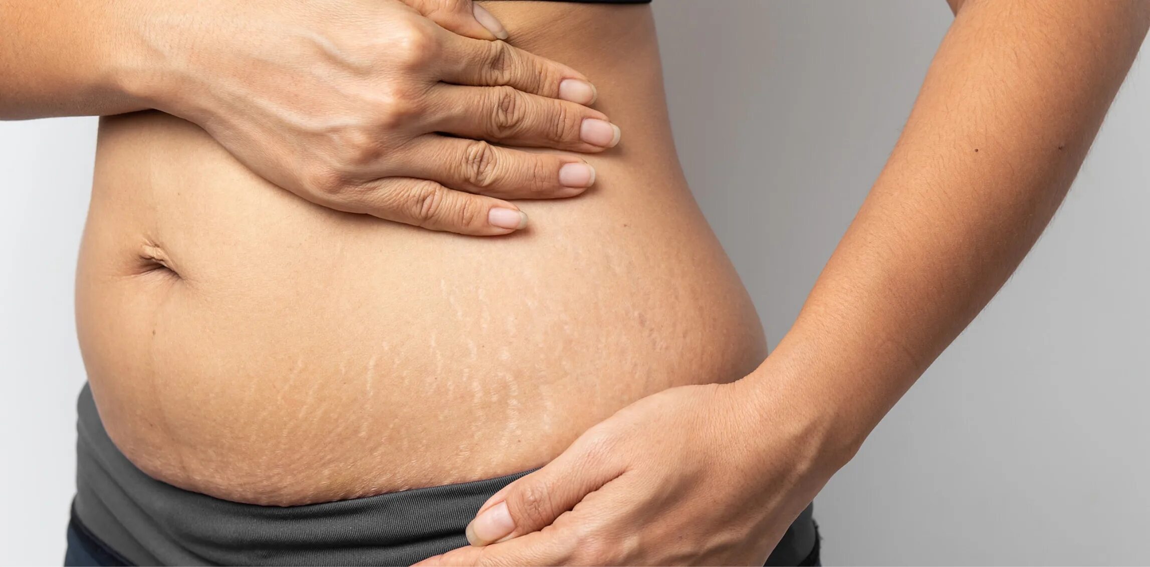 Беременный живот как избавиться. Бульканье в беременном животе. Растяжки при беременности. Беременный живот как избавиться. Как убрать живот после родов.