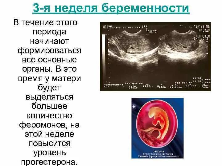 Эмбрион на 2 неделе беременности. Размер плода на 4 неделе беременности. Симптомы беременности на 3 4 недели беременности.