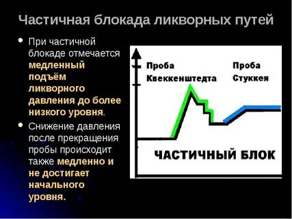 Более низкого уровня