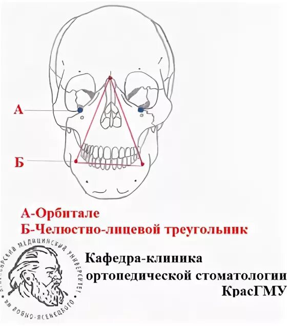 Прыщи в треугольнике смерти. Треугольник смерти на лице топографическая анатомия. Треугольник смерти на лице схема. Треугольник смерти на лице прыщи.