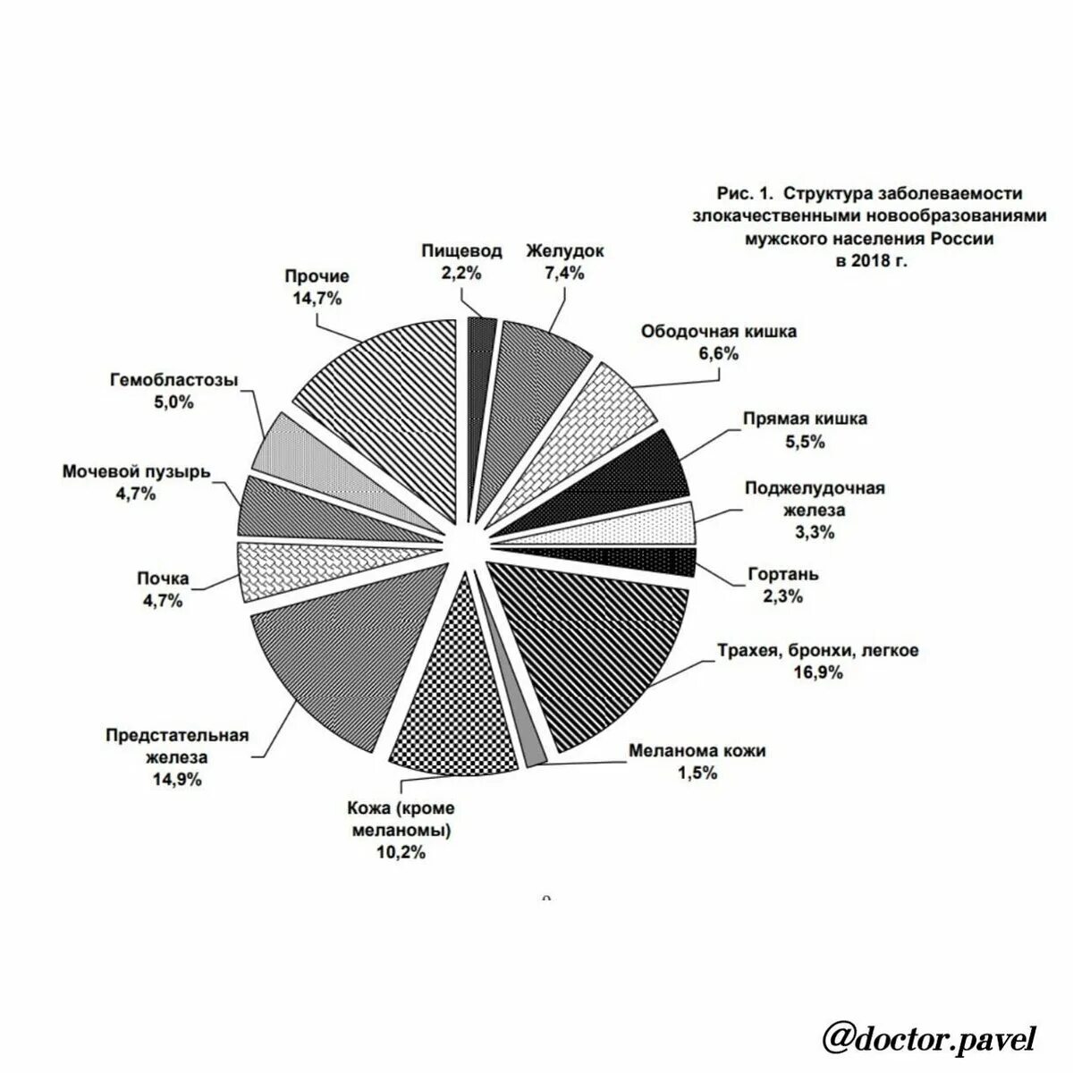 Опухоли статистика. Структура заболеваемости. Структура заболеваемости в России. Структура заболеваемости населения в России. Структура онкологических заболеваний.