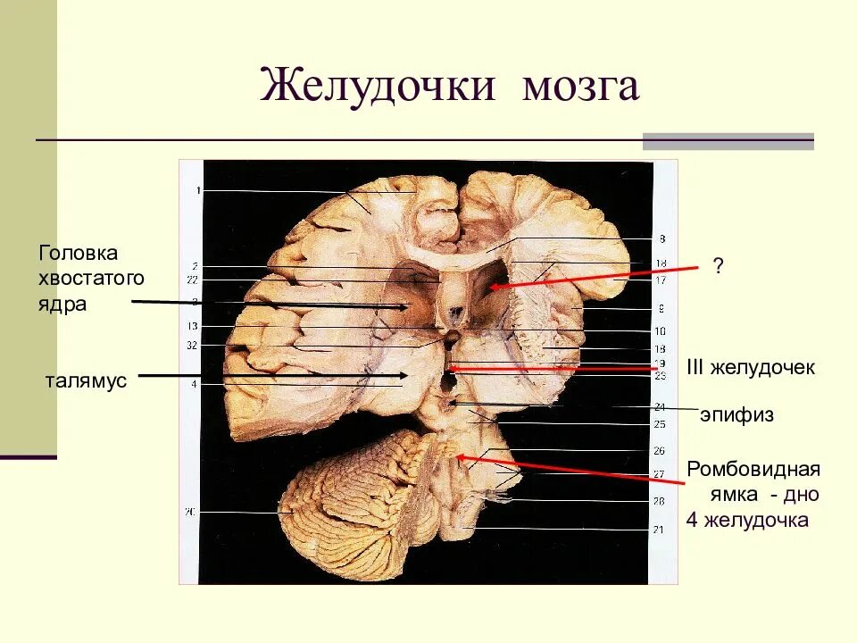 Третий желудочек головного мозга анатомия. 4 Желудочек головного мозга. Проекция желудочков мозга вид слева. Схема желудочков головного мозга.