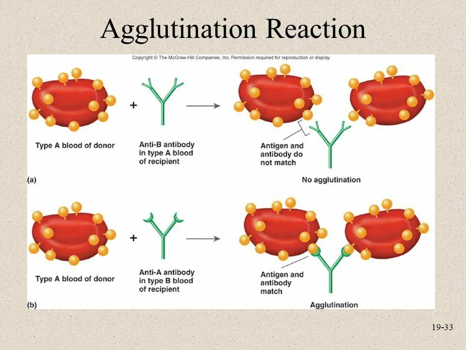Склеивание крови. Агглютинация это склеивание эритроцитов. Реакция агглютинации эритроцитов. Реакция антиген антитело схема. Реакция агглютинации склеивание эритроцитов антителами.