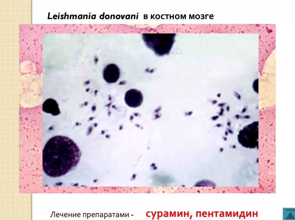 Leishmania donovani. Лейшмания в культуре клеток костного мозга препарат. Лейшмании в костном мозге.