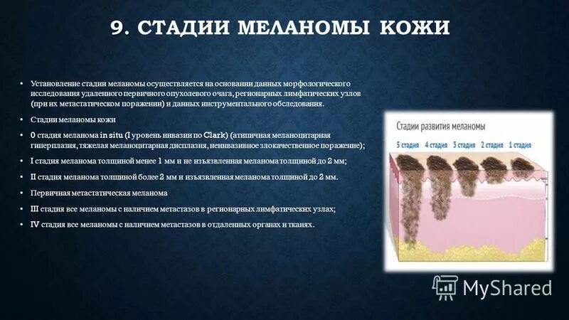 инвазия меланомы по кларку
