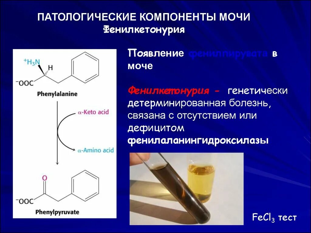 Качественное определение мочи. Патологические компоненты мочи биохимия. фенилкетонурия моча. патологические компоненты в моче. автологические компоненты мочи.