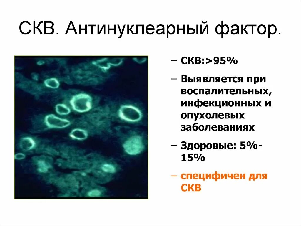 Антинуклеарный фактор норма. Антинуклеарный фактор. Антипикулярный фактор. Антинуклеарный фактор при волчанке.