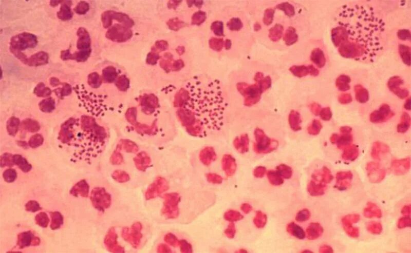 Chlamydia trachomatis mycoplasma genitalium. Уреаплазма уреалитикум микробиология. Микоплазма urealyticum уреаплазмоз. Уреаплазма уреалитикум морфология. Микоплазма микроскопия.