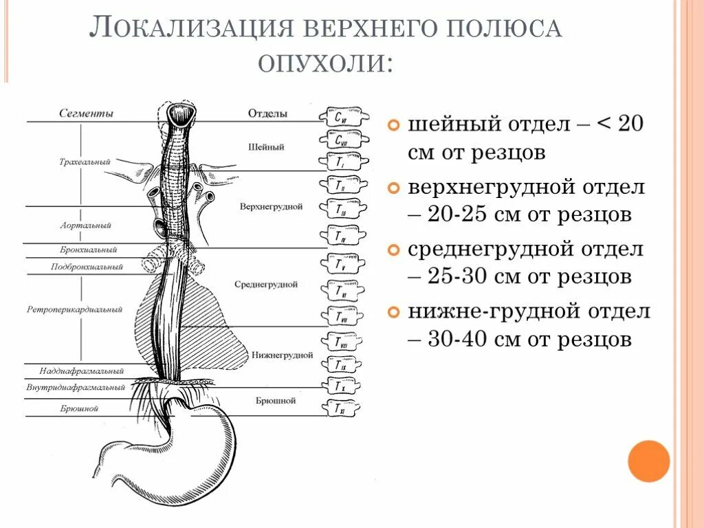 Отделы пищевода в см. Локализация опухоли пищевода. Отделы пищевода по сантиметрам. Сегменты пищевода анатомия.