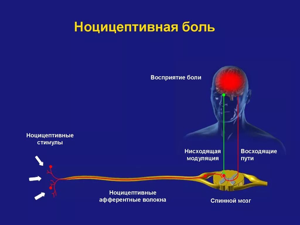 Болезненно воспринял. Схема ноцицептивного анализатора. Болевой анализатор расположение рецепторов. Болевой Рецептор схема. Физиология болевого анализатора. Антиноцицептивная система..