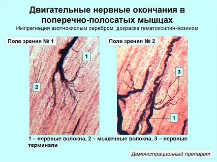 Нервные окончания мышц