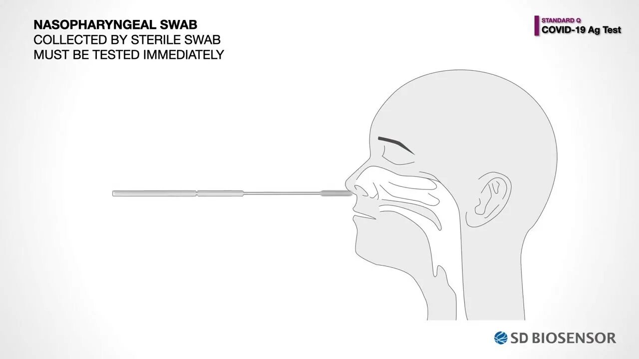 Результат теста covid 19. SD biosensor Standart q Covid˗19 AG.. Biosensor Covid. Standard Covid тест инструкция. Тест biosensor.