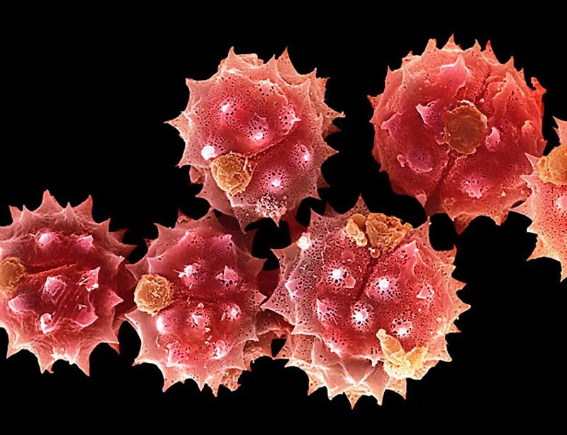 Пыльца коронавирус под микроскопом. Цветочная пыльца под микроскопом. Пыльца растений под микроскопом. Пыльца амброзии под микроскопом. Пыль пыльца