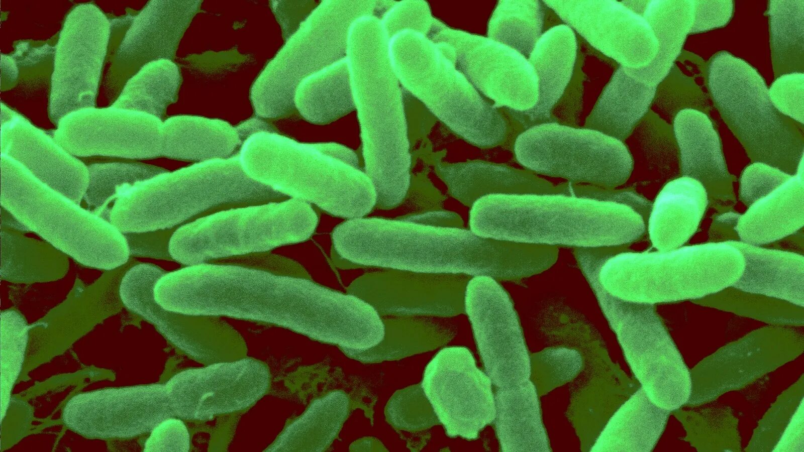 Синегнойная палочка Псевдомония. Псевдомонас аэругиноза. Pseudomonas aeruginosa биохимия. Кандидоз Pseudomonas. Синегнойная палочка возбудитель