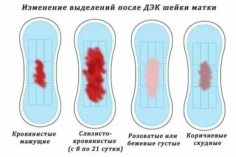 Два месяца после родов выделения