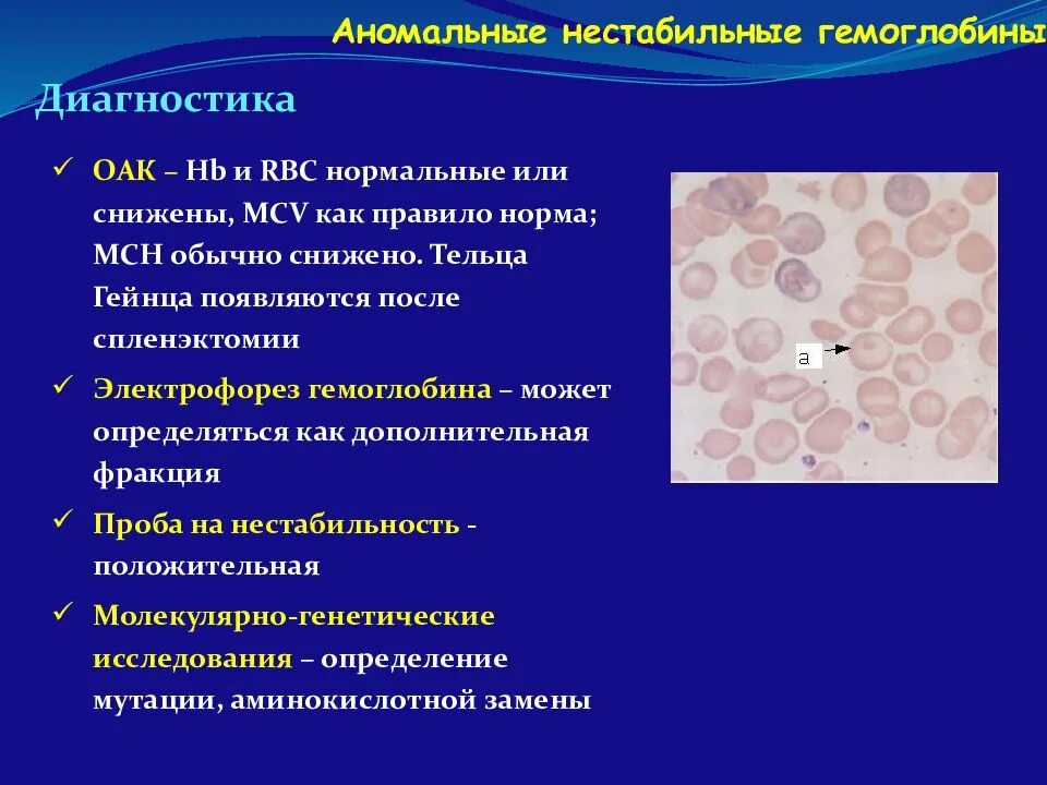 Анемии тельца Гейнца. Тельца Гейнца и тельца Жолли. Тельца Гейнца Эрлиха. Эритроциты с тельцами Гейнца. Тельце гейнца