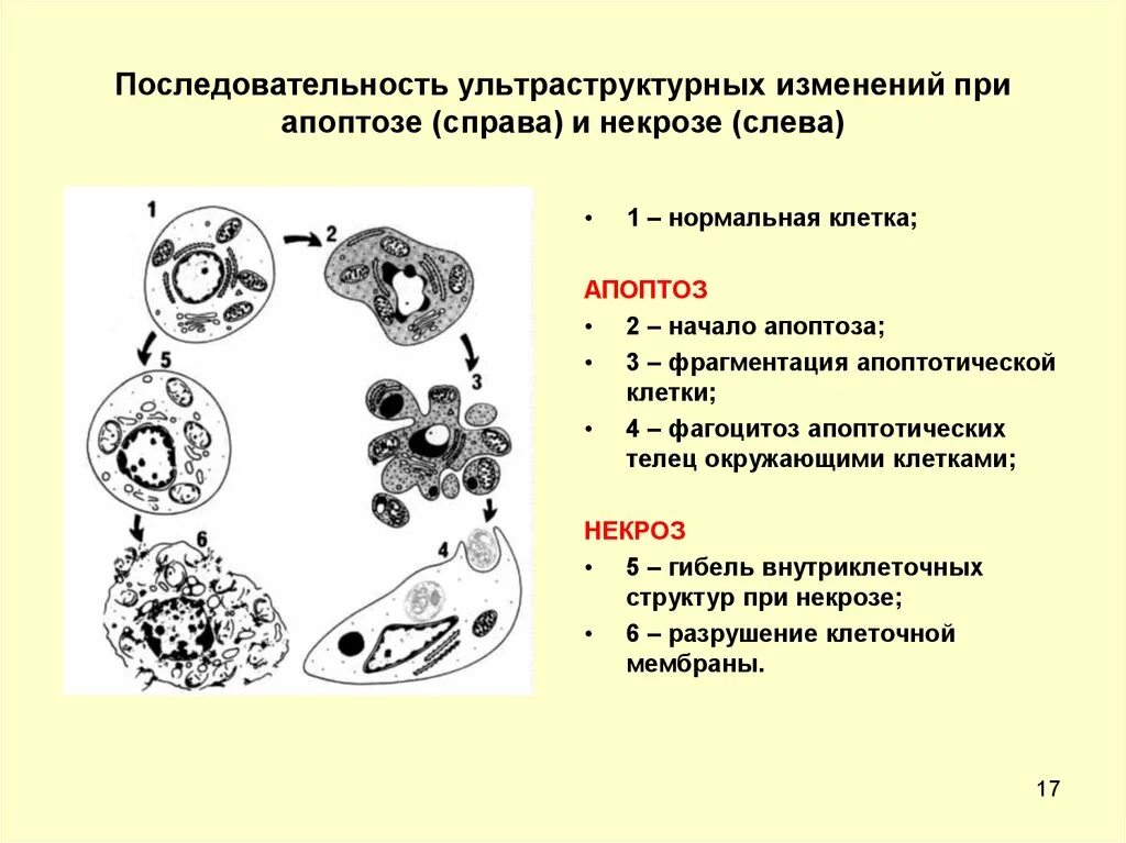 Изменение клетки при некрозе схема. Изменение клетки при некрозе и апоптозе схема. Изменение ядра клетки при некрозе и апоптозе. Изменение ядер клеток при некрозе.