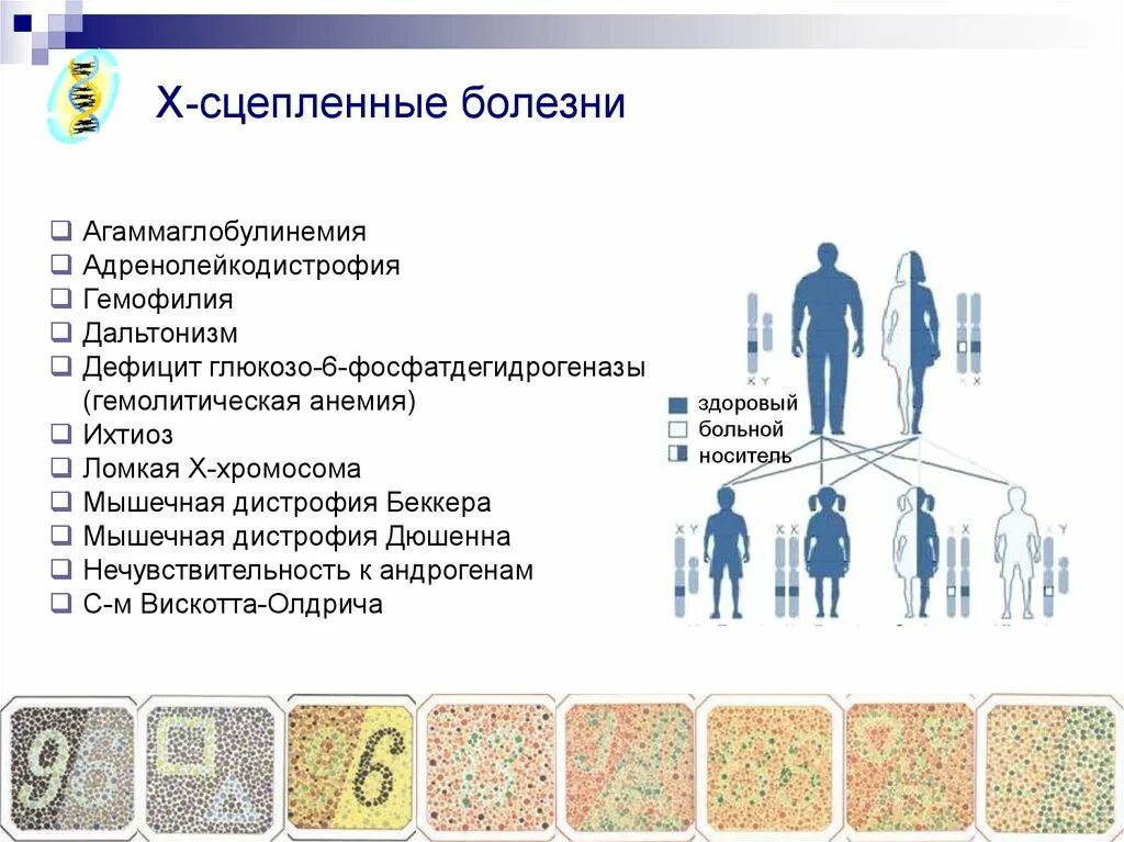 X сцепленные заболевания. X сцепленные доминантные заболевания. Болезни сцепленные с х хромосомой. Х-сцепленный доминантный Тип заболевания. Классическая гемофилия и дальтонизм