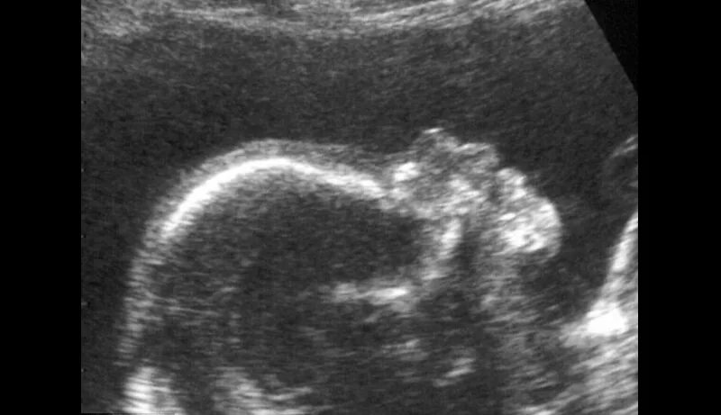 УЗИ 12 недель беременности фото. 12 Недель беременности фото плода на УЗИ. Эмбрион 12 недель УЗИ. УЗИ ребенка на 12 неделе беременности. На 12 неделе тянет