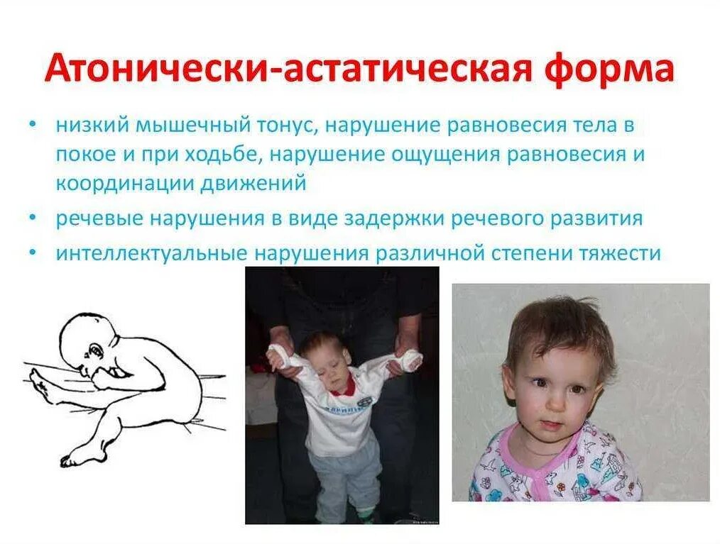 Нарушение координации мышц