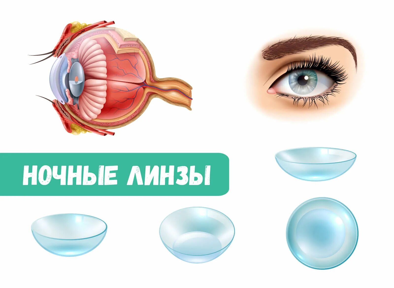 Купить ночные линзы для восстановления зрения цена. Ортокератология ночные линзы. Жесткие ночные линзы для коррекции зрения. Исправление зрения линзами. Линзы корректирующие зрение.