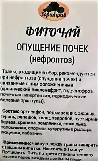 Препараты при опущении почки. Лекарственные препараты при нефроптозе. Лекарства от нефроптоза почек. Лекарство при нефроптозе почек. Боли при опущении почки