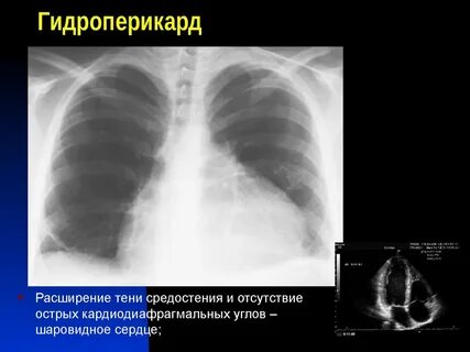 Незначительное расширение