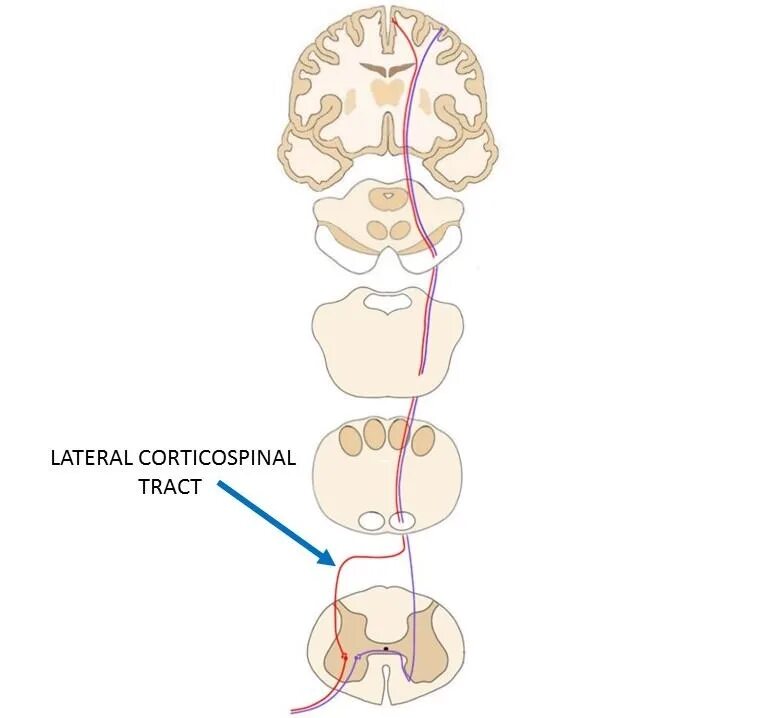 Pyramid spin. Pyramidal decussation. Lateral corticospinal tract. Spinal Cord pyramidal decussation. Rubrospinal tract Pathway.