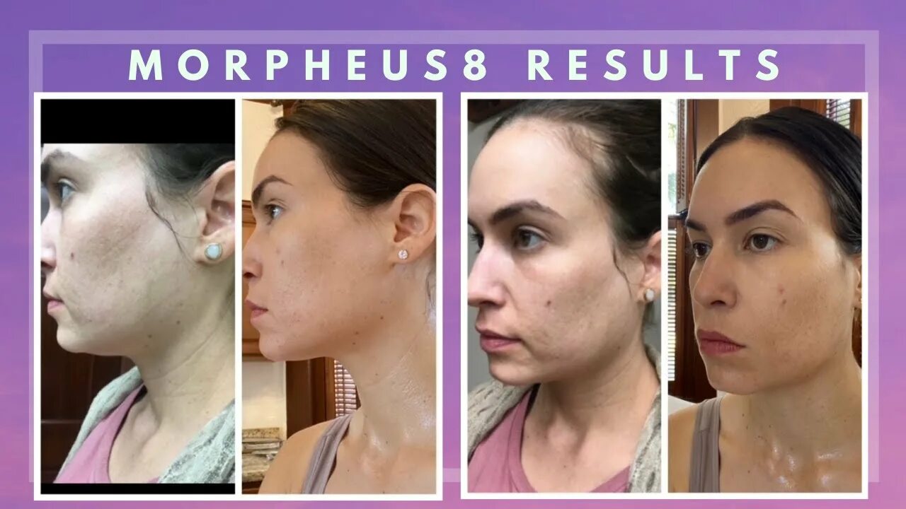 Морфеус косметология отзывы. Морфеус косметология отзывы. Морфеус косметология отзывы. Морфеус косметология отзывы. Морфеус косметология отзывы.