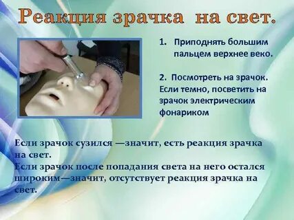 Реакция зрачка на свет признак
