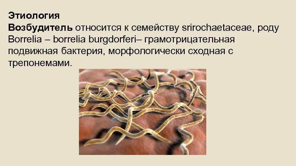 Днк borrelia. Иксодовый клещевой боррелиоз возбудитель. Днк borrelia. Днк borrelia. Клинические проявления 1 стадии боррелиоза.