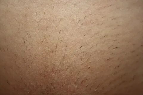Зачем растут волосы в интимных местах