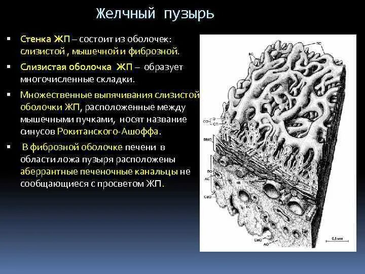 Люнд слизистой оболочки. Синусы Рокитанского Ашоффа. Ходы Люшка желчного пузыря. Складка слизистой оболочки желчного пузыря. Ходы Люшка желчного пузыря гистология.