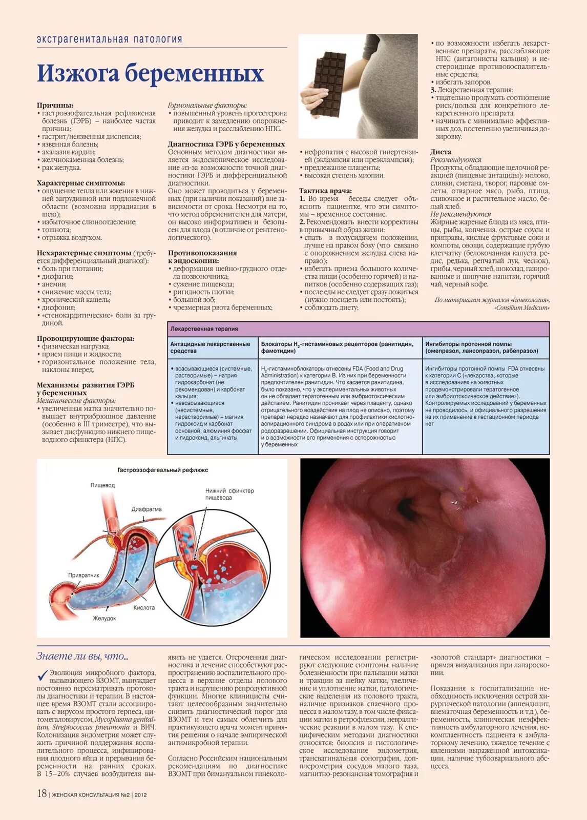 Изжога во 2 триместре. Изжоге прибеременночти. Изжога при беременности. Симптомы изжоги у беременных. Изжога при беременности причины.