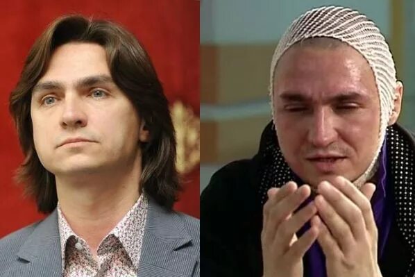 Артист балета филин. Сергей филин балет. сергей филин облили кислотой. сергей филин кислота. филин сергей большой театр.