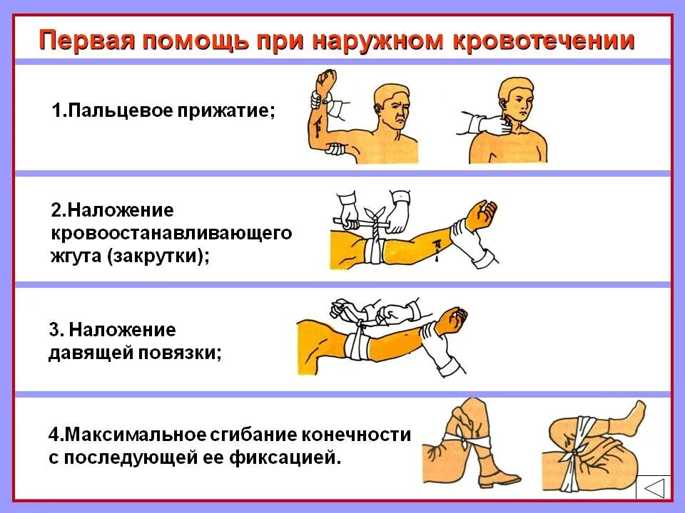 Оказание первой помощи сильное кровотечение. Алгоритм оказания первой помощи при наружном кровотечении. Правила оказания первой доврачебной помощи при кровотечениях. Первая помощь при наружных кровотечениях алгоритм действий. Оказание первой помощи при артериальном и венозном кровотечении.