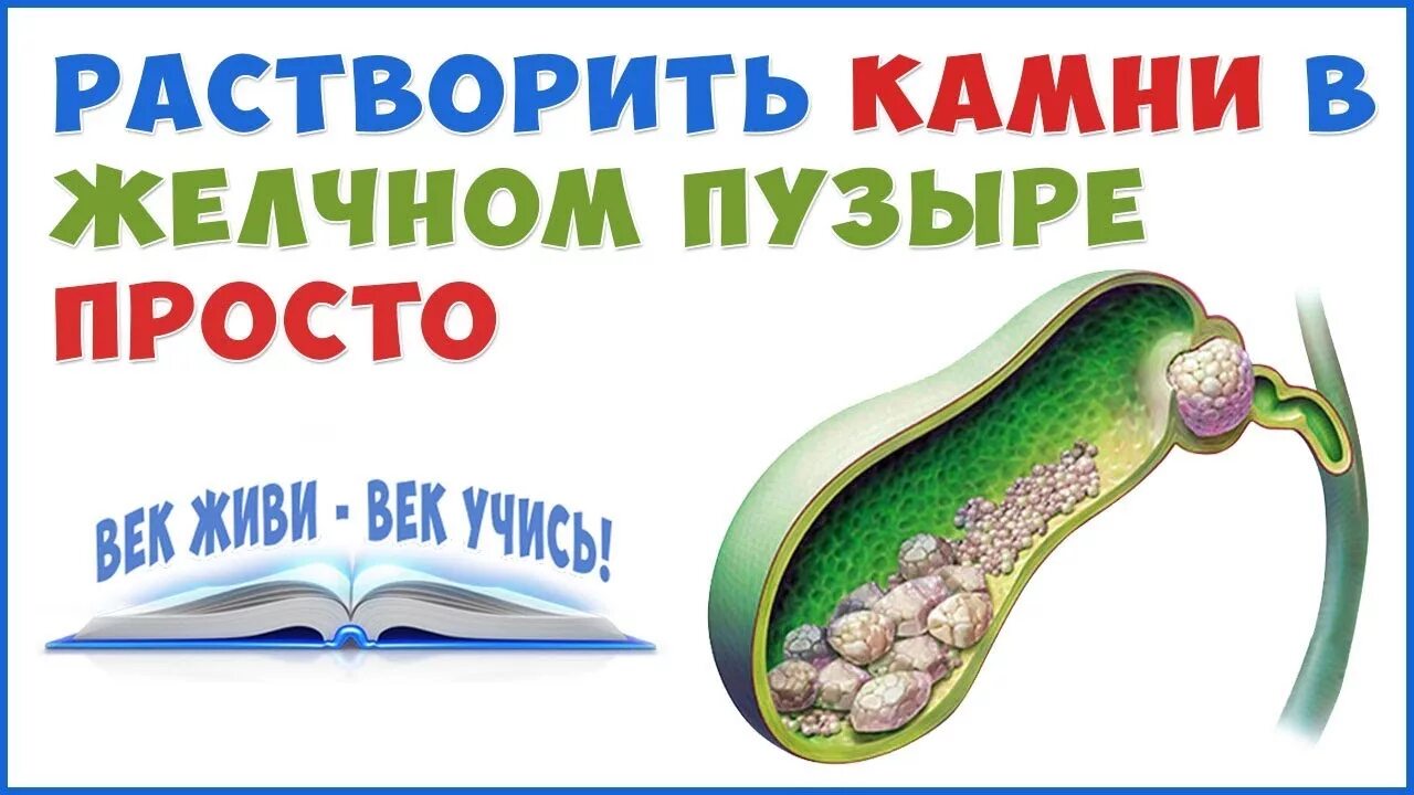 Растворить камни в желчном пузыре народными. Растворение камней в желчном пузыре. Растворимые камни в желчном пузыре. Препараты для растворения желчных камней. Желчные камни растворились.