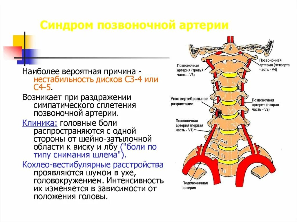 Позвоночная артерия в костном канале