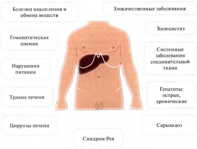 Гепатомегалия печени что это такое у женщин. Гепатомегалия конституциональная. Гепатомегалия при анемии. Гепатомегалия при болезнях крови. Гепатомегалия край печени.