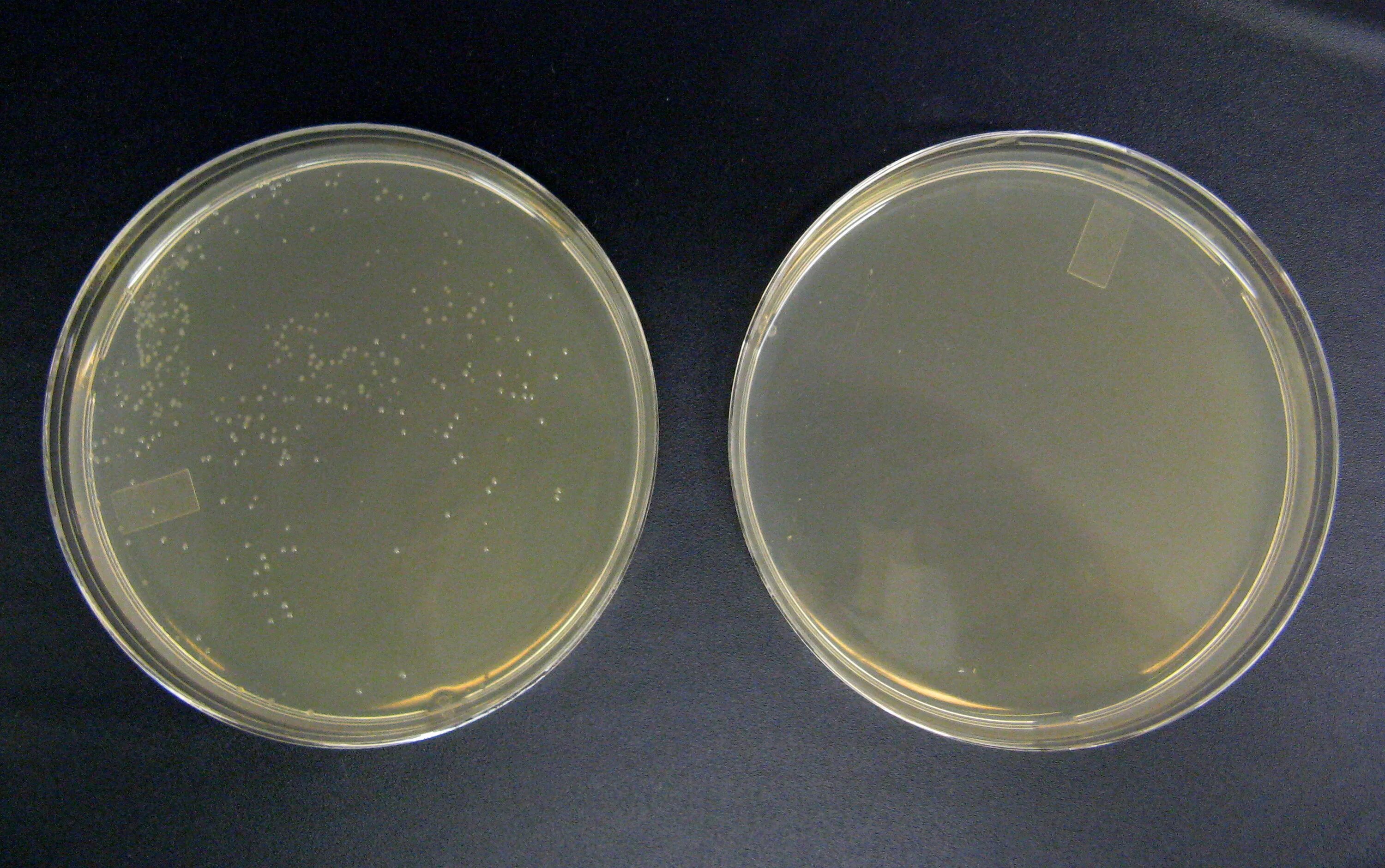 Pseudomonas aeruginosa микробиология. Pseudomonas aeruginosa колонии. Бактерия Pseudomonas Fluorescens. Pseudomonas aeruginosa Ванкомицин.