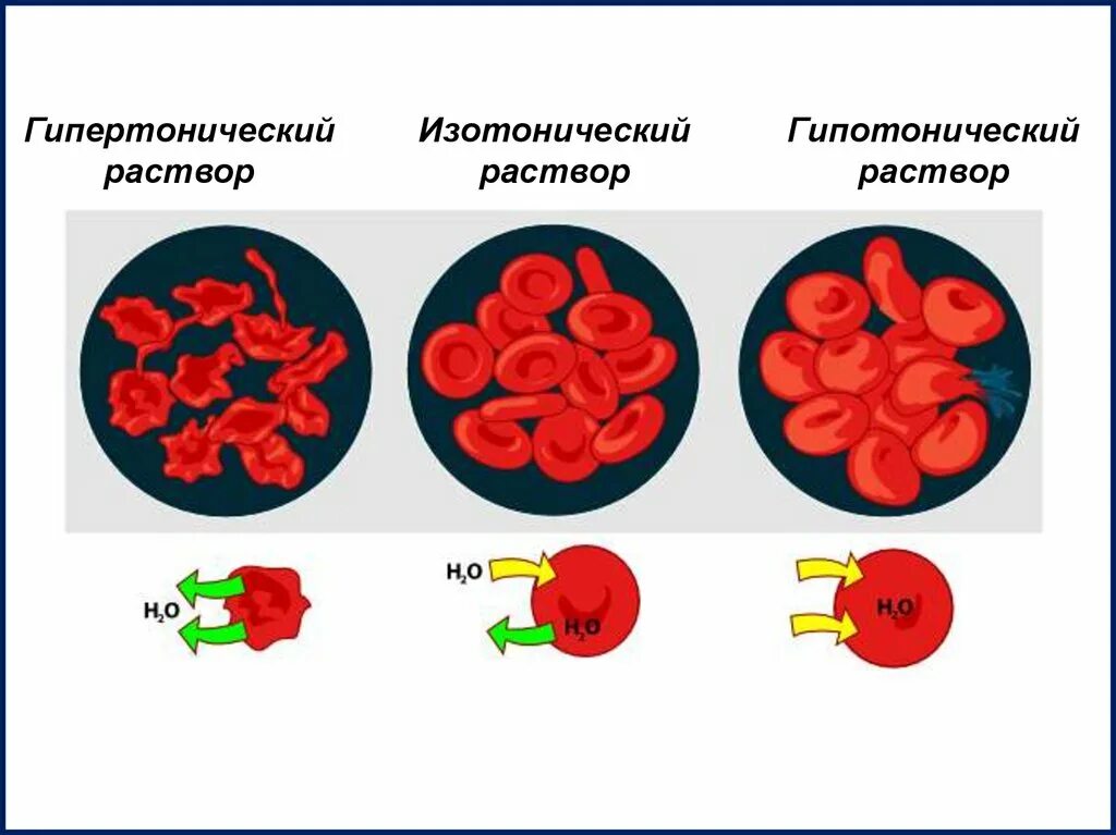 Плазмолиз раствор. Изотонический гипертонический и гипотонический растворы. Виды растворов изотонический гипертонический и гипотонический. Плазмолиз гипертонический раствор. Плазмолиз эритроцитов происходит в растворе.