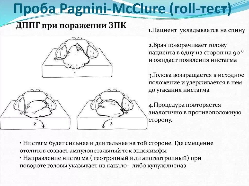 Дппг что это за болезнь. Гимнастика Брандта Дароффа. Проба Брандта Дароффа. Пробы при ДППГ горизонтального. Доброкачественное пароксизмальное головокружение упражнения.