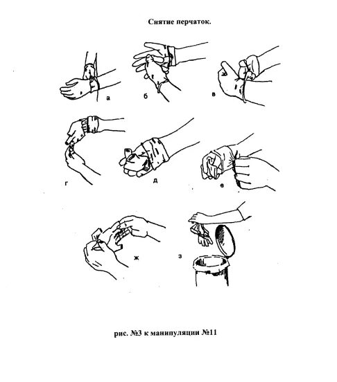 Манипуляция перчатка. Схема снятия стерильных перчаток. Надевание и снятие стерильных перчаток. Техника надевания и снятия стерильных перчаток. Схема одевание и снятие стерильных перчаток.