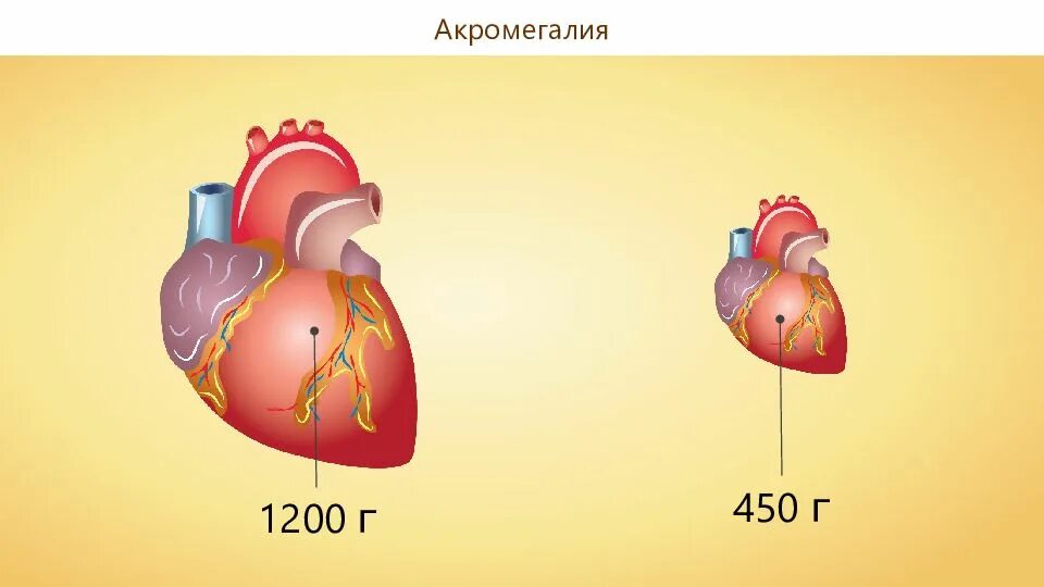 Эндокринная система сердца. Работа эндокринной системы и её нарушения 8 класс презентация. Презентация работа эндокринной системы и ее нарушения. Нарушение работы эндокринной системы таблица 8 класс биология.