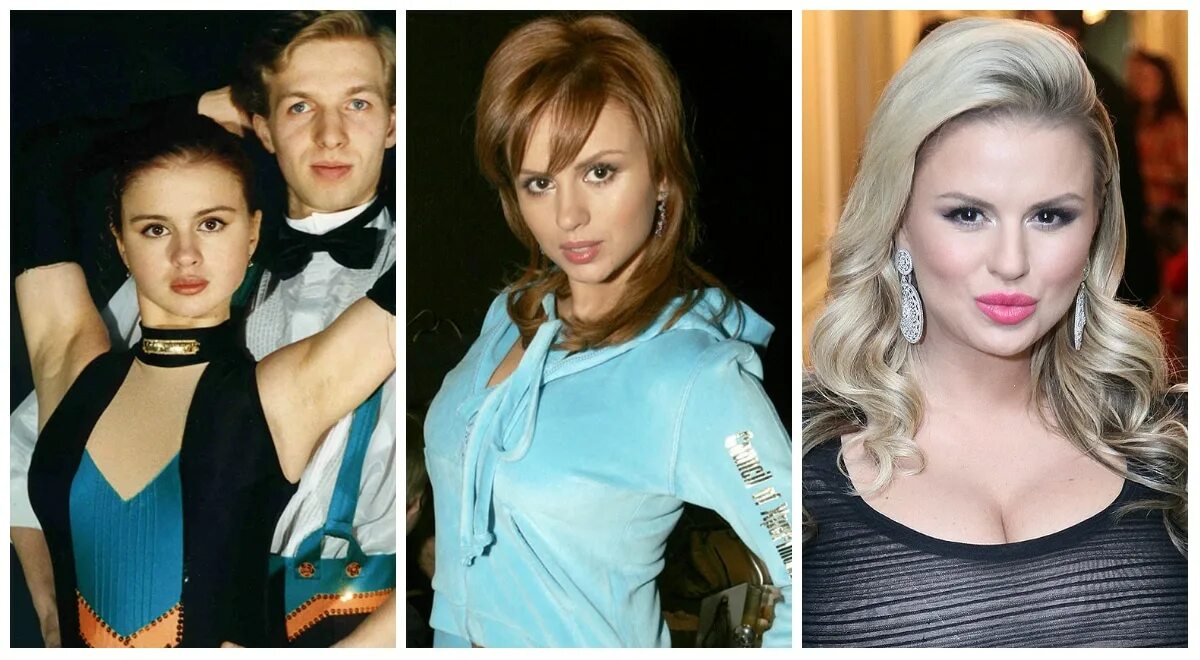 Анна семенович до и после. Анна семенович. Анна семенович до пластики. Анна семенович в молодости и сейчас. Анна семенович в юности.