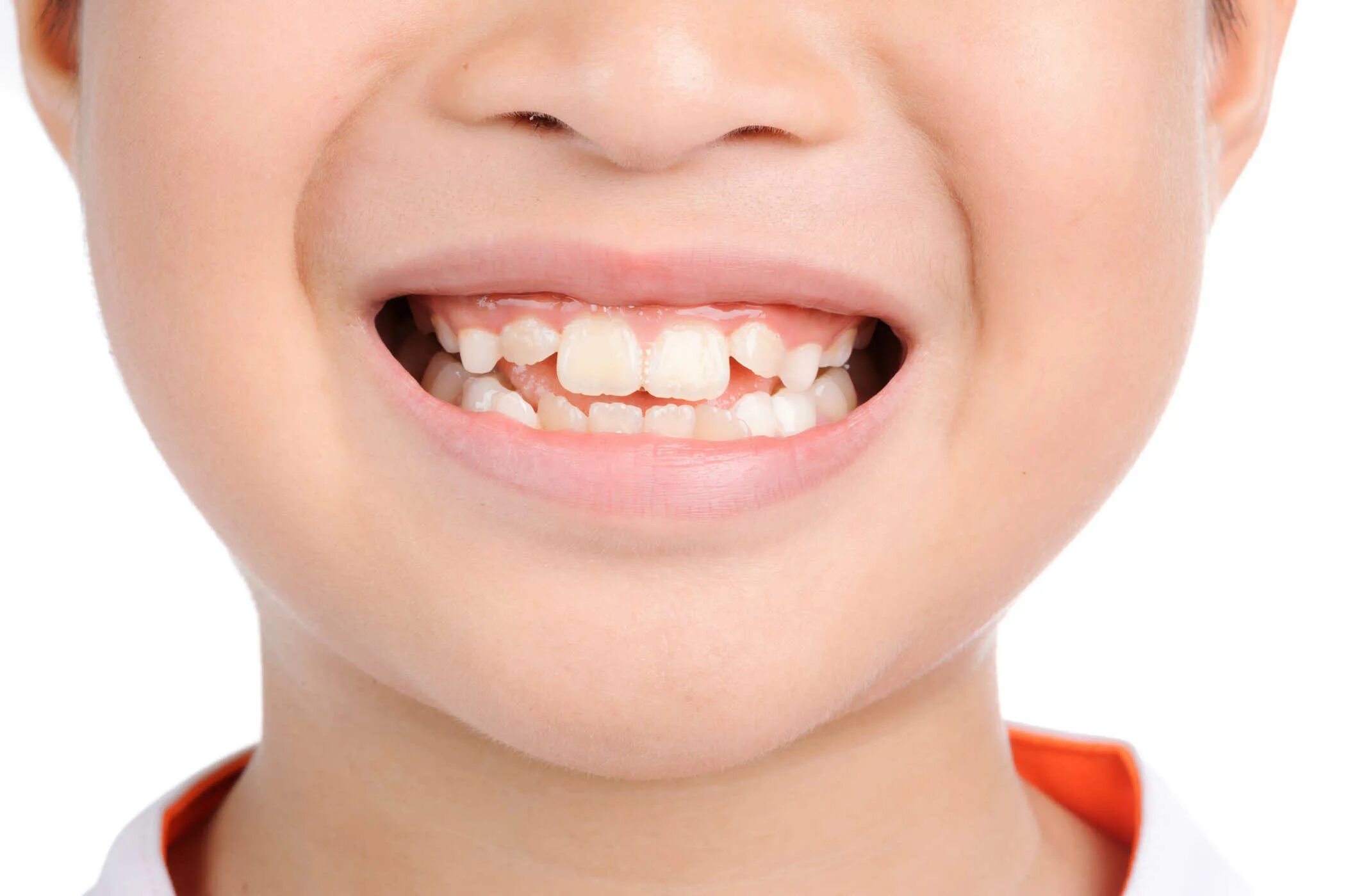 Молочные зубы картинки. У детей белоснежный зубы. Ровные зубы у детей.